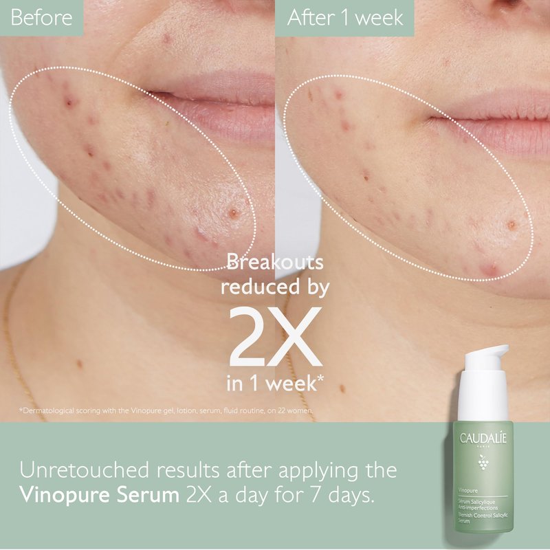 Caudalie Vinopure Natural Salicylic Acid Pore Minimizing Serum with Niacinamide, Skin Perfecting Serum - 30 mL