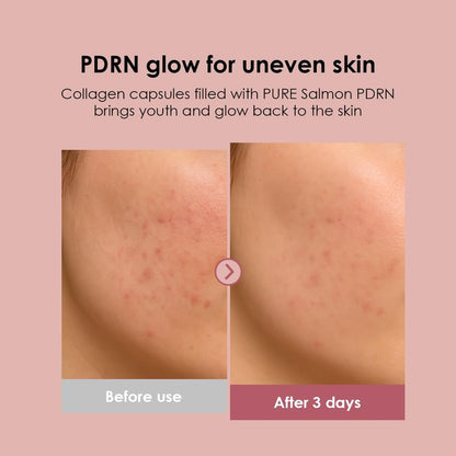 glowiest PDRN Capsule Glow Serum – Encapsulated PDRN + Collagen + Snail Mucin, Hydrating Serum for Youthful Glow, 300Da Collagen, 50ml