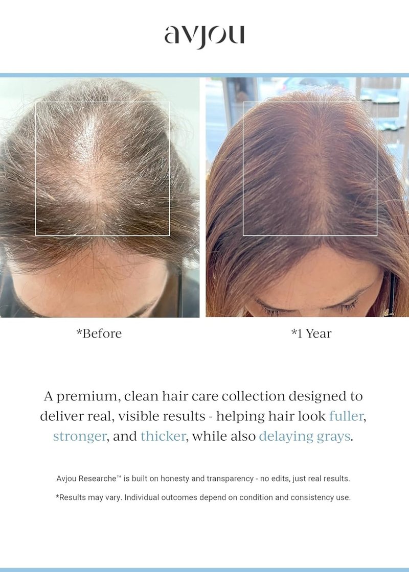 Avjou Researche™ Scalp Serum - Thicker, Fuller Hair | Targets Premature Greying - 1.7 oz