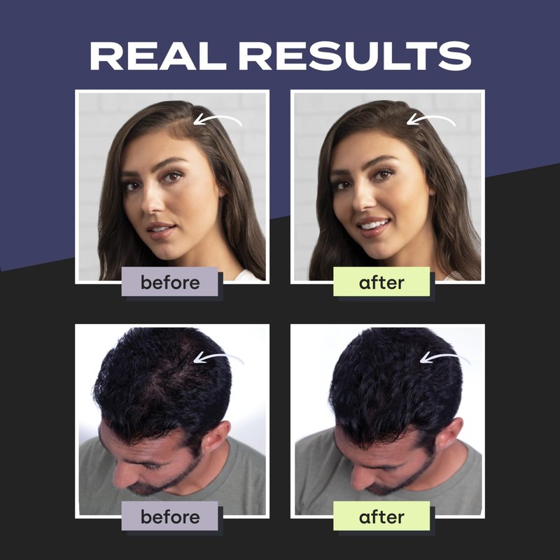 Toppik Hair Building Fibers, Light Blonde, 12g Fill In Fine or Thinning Hair, Instantly Thicker, Fuller Looking, 9 Shades for Men & Women, Keratin Protein Formula