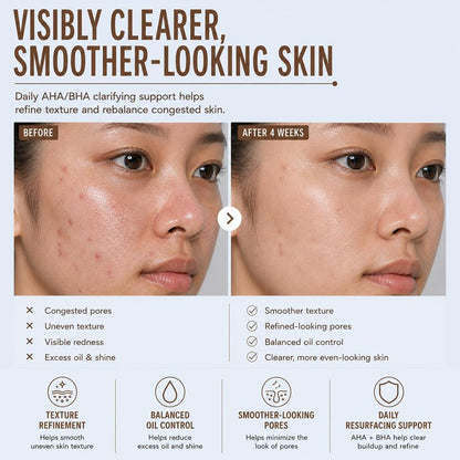 Pixi Beauty Clarity Tonic, AHA & BHA Toner | Minimize Pores, Promote A Clearer, Healthier Complexion, 250 ml