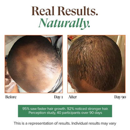 Kreyol Essence - Haitian Black Castor Oil for Skin and Hair, Glass Bottle - Fuller-Looking Hair, Pure, Hexane Free, Cold Pressed, Natural Humectant (Original, 3.4 fl oz)