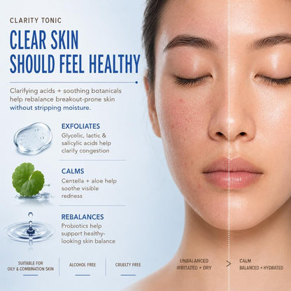 Pixi Beauty Clarity Tonic, AHA & BHA Toner | Minimize Pores, Promote A Clearer, Healthier Complexion, 250 ml