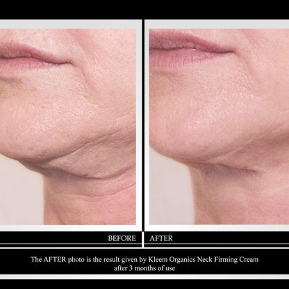 Kleem Neck Firming Cream for Sagging Skin - Anti Aging Neck Cream with Retinol & Panthenol - Firming Neck & Décolleté Cream Parent, Smooths Fine Lines & Wrinkles 1.7 Fl Oz