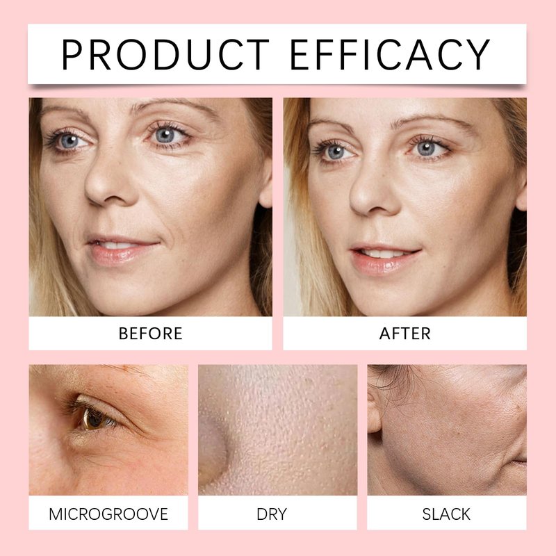 Finones Skin Vitamin Serum for Face & Body, 5 in 1 Anti Wrinkle Firming Serum, Anti-Aging Essence with Hyaluronic Acid, Collagen, Lifting Firming Essence, Hydrate Moisturize, Reduce Fine Lines