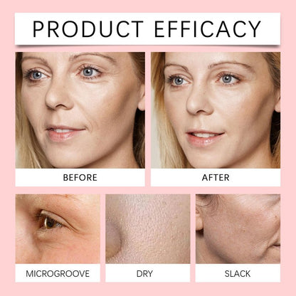 Finones Skin Vitamin Serum for Face & Body, 5 in 1 Anti Wrinkle Firming Serum, Anti-Aging Essence with Hyaluronic Acid, Collagen, Lifting Firming Essence, Hydrate Moisturize, Reduce Fine Lines
