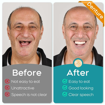 Do It Yourself Dentures Fake -Teeth Top and Bottom Temporary Teeth-DIY Denture Kit-Temporary Denture Kit for Women and Men-Tooth Replacement Kit-Create Your Perfect Smile at Home-20260108