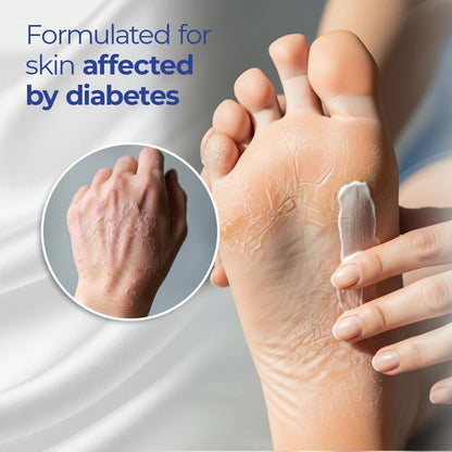 Goicoechea Diabet TX Diabetic Lotion with Urea for Dry Skin | Soothing Hydrating Cream with Aloe, Oatmeal & Vitamin E for Hands, Elbows, Feet & Body | Extra Dry Skin Support, 13.5 Oz | 3-Pack
