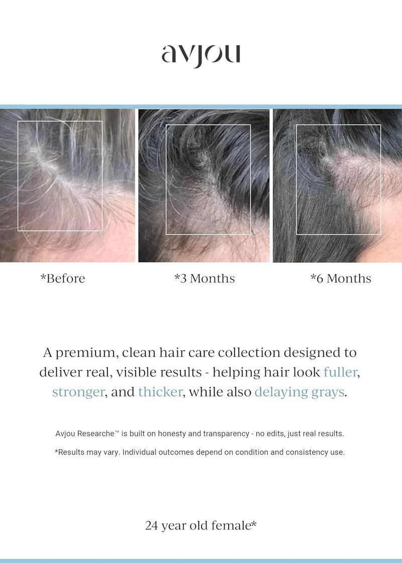 Avjou Researche™ Scalp Serum - Thicker, Fuller Hair | Targets Premature Greying - 1.7 oz
