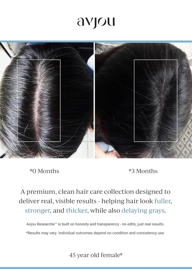 Avjou Researche™ Scalp Serum - Thicker, Fuller Hair | Targets Premature Greying - 1.7 oz