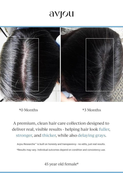 Avjou Researche™ Scalp Serum - Thicker, Fuller Hair | Targets Premature Greying - 1.7 oz