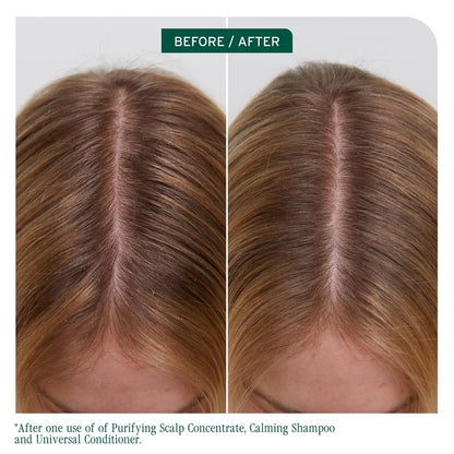 Biolage Scalp Sync Calming Shampoo - Gently Cleanses Dry & Sensitive Scalps, Hydrates & Soothes, Fermented Tea Blend & Glycolic Acid, Vegan & Paraben-Free