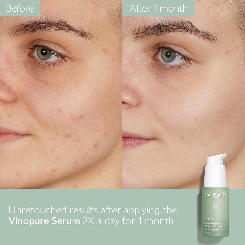 Caudalie Vinopure Natural Salicylic Acid Pore Minimizing Serum with Niacinamide, Skin Perfecting Serum - 30 mL