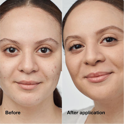 Clinique Even Better Clinical Serum Liquid Foundation SPF 25 With Vitamin C, Salicylic Acid + Hyaluronic Acid For Combination to Oily Skin Types | Full Coverage + Matte Finish, Neutral, 1 Fl Oz